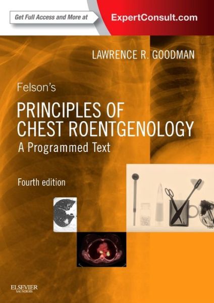 Cover for Goodman · Felson's Principles of Chest Ro (Book) [4 Revised edition] (2014)