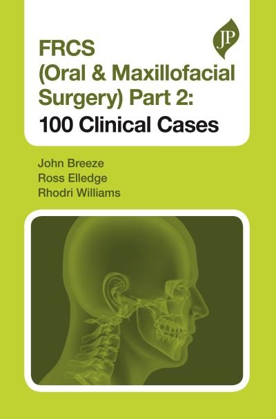 Cover for John Breeze · FRCS (Oral &amp; Maxillofacial Surgery) Part 2: 100 Clinical Cases - Postgraduate (Pocketbok) (2019)