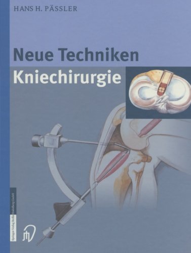 Cover for H H Passler · Neue Techniken Kniechirurgie (Pocketbok) [Softcover Reprint of the Original 1st 2002 edition] (2012)