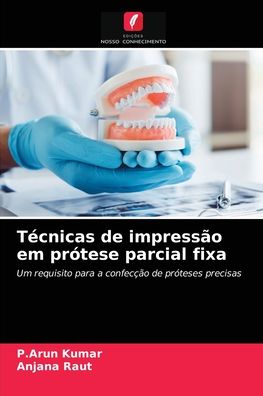 Cover for P Arun Kumar · Tecnicas de impressao em protese parcial fixa (Paperback Book) (2021)