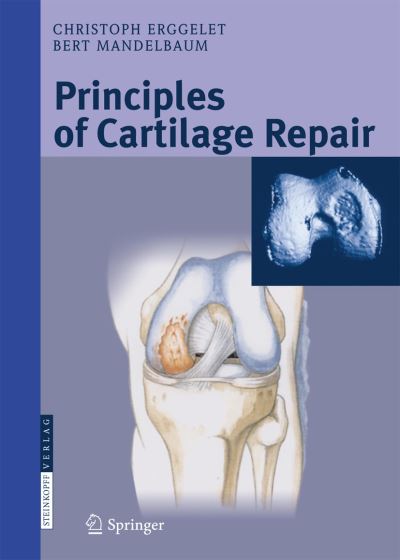 Cover for Christoph Erggelet · Principles of Cartilage Repair (Paperback Book) [Softcover reprint of the original 1st ed. 2008 edition] (2016)