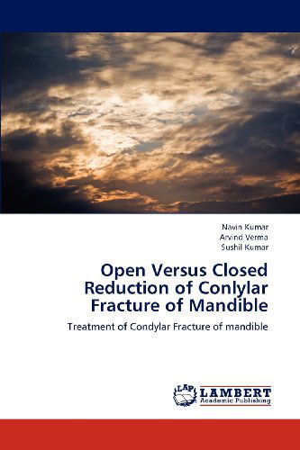 Cover for Sushil Kumar · Open Versus Closed Reduction of Conlylar Fracture of Mandible: Treatment of Condylar Fracture of Mandible (Pocketbok) (2013)