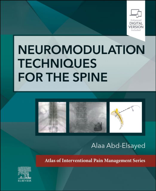 Cover for Abd-Elsayed, Alaa, MD, MBA, MPH, CPE, FASA (University of Wisconsin) · Neuromodulation Techniques for the Spine: A Volume in the Atlas of Interventional Pain Management Series (Hardcover Book) (2023)