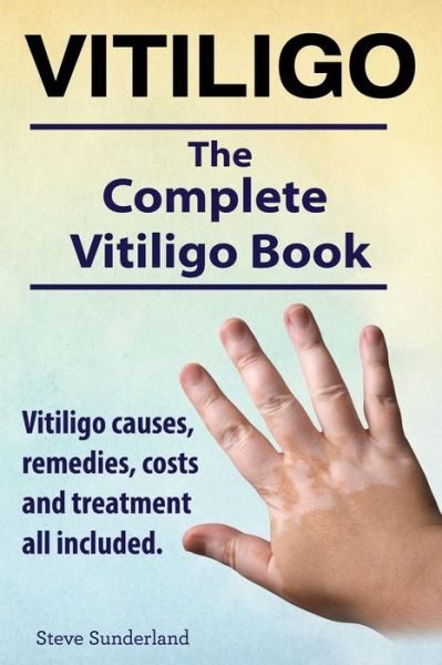 Cover for Steve Sunderland · Vitiligo. Vitiligo Causes, Remedies, Costs and Treatment All Included. the Complete Vitiligo Book. (Paperback Book) (2014)