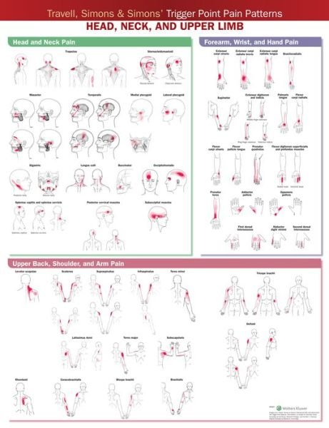 Cover for Acc · Travell, Simons &amp; Simons’ Trigger Point Pain Patterns Wall Chart: Head, Neck, and Upper Limb (Kort) (2021)
