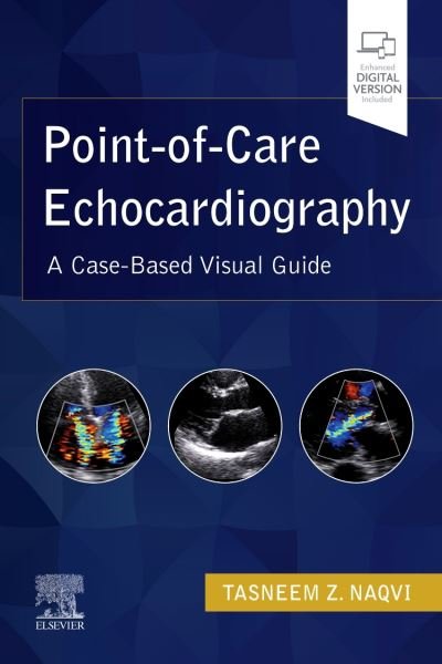 Cover for Naqvi, Tasneem Z., MD, FRCP (Lon.UK), MMM, FASE, FACC (Professor of Medicine, Mayo College of Medicine, Consultant, Department of Cardiovascular Disease, Mayo Clinic, Scottsdale, Arizona, USA) · Point-of-Care Echocardiography: A Clinical Case-Based Visual Guide (Taschenbuch) (2021)