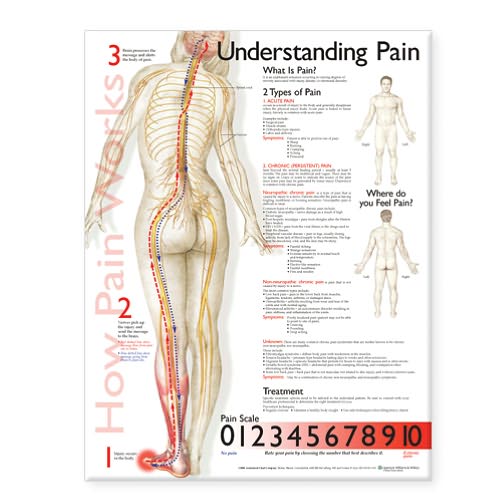 Cover for Acc · Understanding Pain Anatomical Chart (Landkarten) (2006)