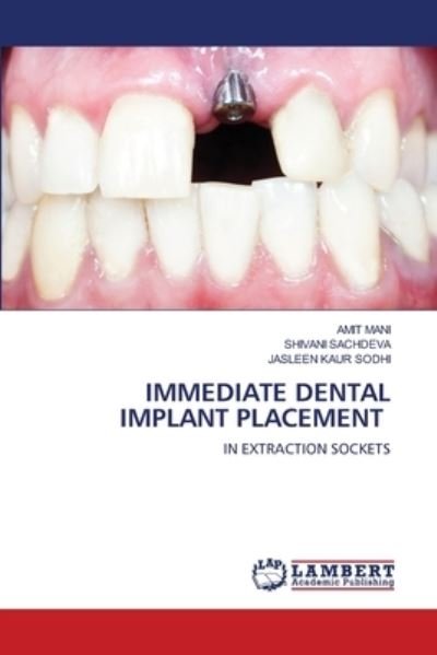 Cover for Mani · Immediate Dental Implant Placement (N/A) (2021)