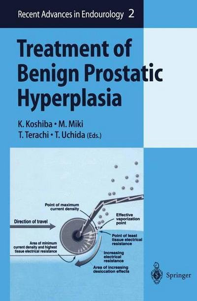 Treatment of Benign Prostatic Hyperplasia - Recent Advances in Endourology (Hardcover Book) [2000 edition] (2000)