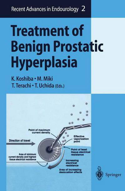 Treatment of Benign Prostatic Hyperplasia - Recent Advances in Endourology -  - Books - Springer Verlag, Japan - 9784431702849 - July 1, 2000