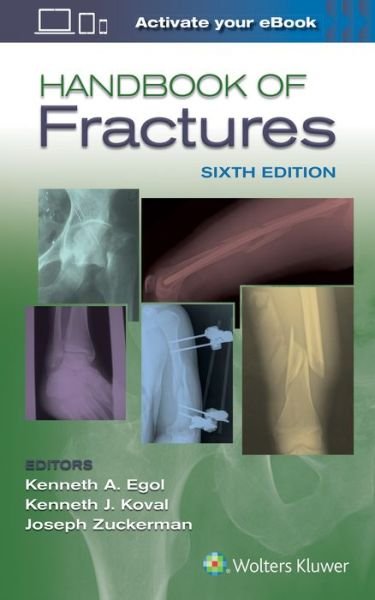 Cover for Egol · Handbook of Fractures (Paperback Book) (2019)