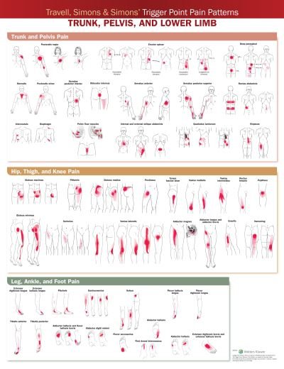 Cover for Acc · Travell, Simons &amp; Simons’ Trigger Point Pain Patterns Wall Chart: Trunk, Pelvis, and Lower Limb (Landkarten) (2021)
