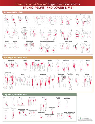 Travell, Simons & Simons’ Trigger Point Pain Patterns Wall Chart: Trunk, Pelvis, and Lower Limb - Acc - Bücher - Wolters Kluwer Health - 9781975183851 - 24. August 2021