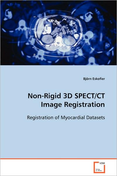 Non-rigid 3D Spect/ct Image Registration: Registration of Myocardial Datasets - Björn Eskofier - Books - VDM Verlag - 9783639089851 - October 6, 2008