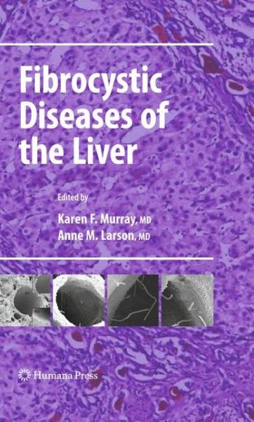 Cover for Karen F Murray · Fibrocystic Diseases of the Liver - Clinical Gastroenterology (Taschenbuch) [2010 edition] (2012)