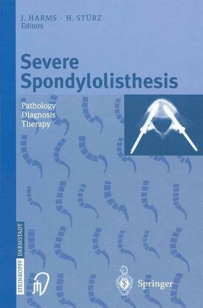 Cover for J Harms · Severe Spondylolisthesis: Pathology - Diagnosis - Therapy (Paperback Book) [Softcover reprint of the original 1st ed. 2002 edition] (2012)
