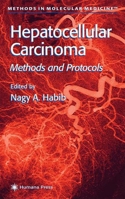 Cover for Nagy a Habib · Hepatocellular Carcinoma: Methods and Protocols - Methods in Molecular Medicine (Hardcover Book) [2000 edition] (2000)