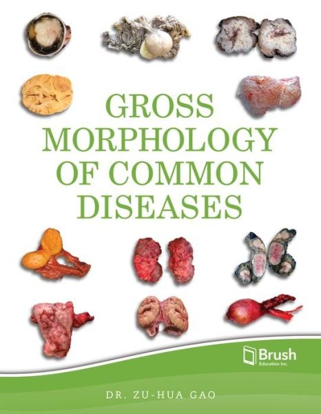 Gross Morphology of Common Diseases - Zu-Hua Gao - Books - Brush Education Inc - 9781550596854 - February 7, 2020