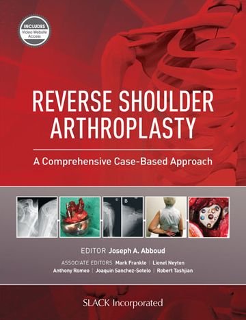 Cover for Joseph Abboud · Reverse Shoulder Arthroplasty: A Comprehensive Case-Based Approach (Inbunden Bok) (2021)