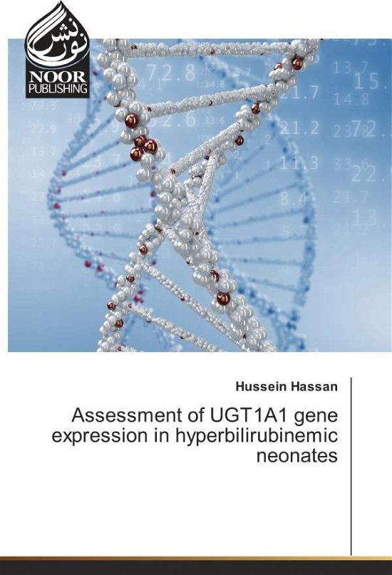 Cover for Hassan · Assessment of UGT1A1 gene expres (Book)
