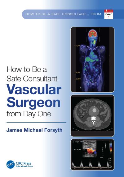 Cover for James Forsyth · How to be a Safe Consultant Vascular Surgeon from Day One: The Unofficial Guide to Passing the FRCS (VASC) (Inbunden Bok) (2022)