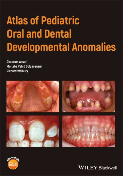 Cover for Ghassem Ansari · Atlas of Pediatric Oral and Dental Developmental Anomalies (Paperback Book) (2019)