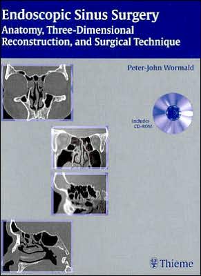 Cover for Peter J. Wormald · Endoscopic Sinus Surgery (Book) (2004)