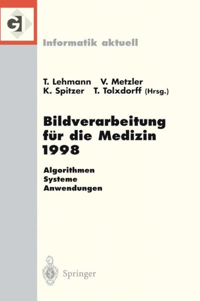 Bildverarbeitung Fur Die Medizin 1998: Algorithmen -- Systeme -- Anwendungen Proceedings Des Workshops Am 26. Und 27. Marz 1998 in Aachen - Informatik Aktuell - Thomas Lehmann - Książki - Springer-Verlag Berlin and Heidelberg Gm - 9783540638858 - 18 marca 1998