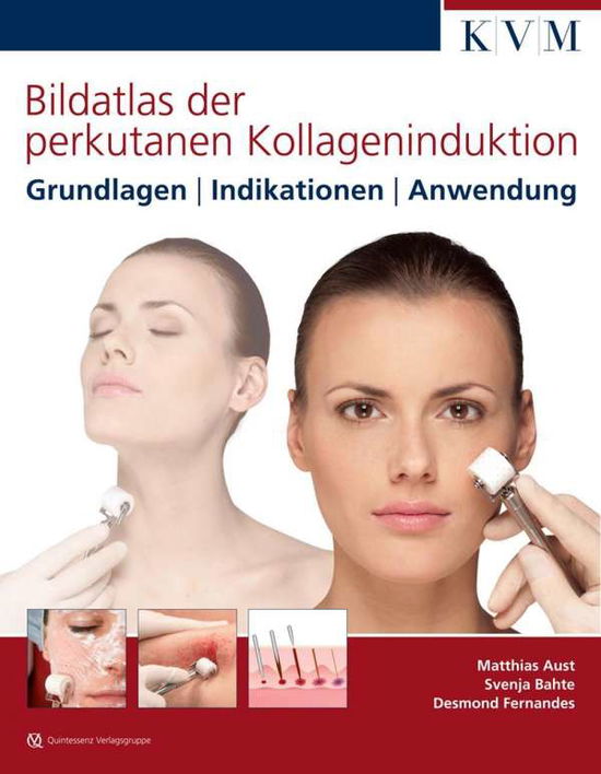 Cover for Aust · Bildatlas der perkutanen Kollageni (Buch)