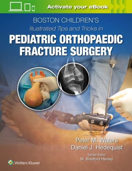 Boston Children’s Illustrated Tips and Tricks  in Pediatric Orthopaedic Fracture Surgery - Waters - Bøger - Wolters Kluwer Health - 9781975103859 - 28. november 2019