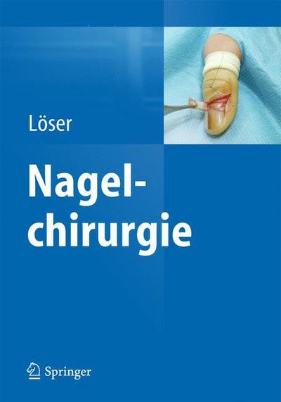 Nagelchirurgie - Christoph Loser - Książki - Springer Berlin Heidelberg - 9783642351860 - 13 czerwca 2026