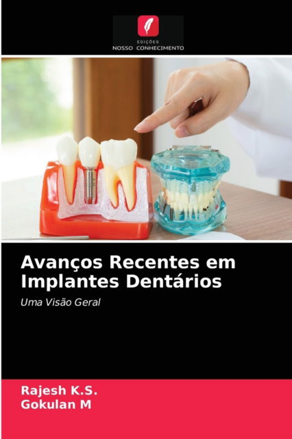 Cover for Rajesh K S · Avancos Recentes em Implantes Dentarios (Paperback Book) (2021)