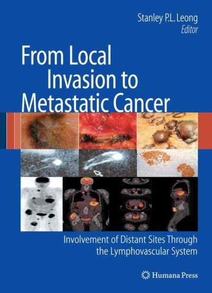 Cover for Stanley P L Leong · From Local Invasion to Metastatic Cancer: Involvement of Distant Sites Through the Lymphovascular System - Current Clinical Oncology (Hardcover Book) [2009 edition] (2009)