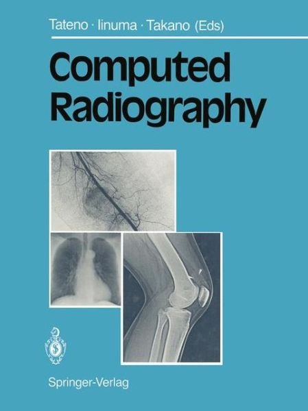Yukio Tateno · Computed Radiography (Paperback Book) [Softcover reprint of the original 1st ed. 1987 edition] (2012)