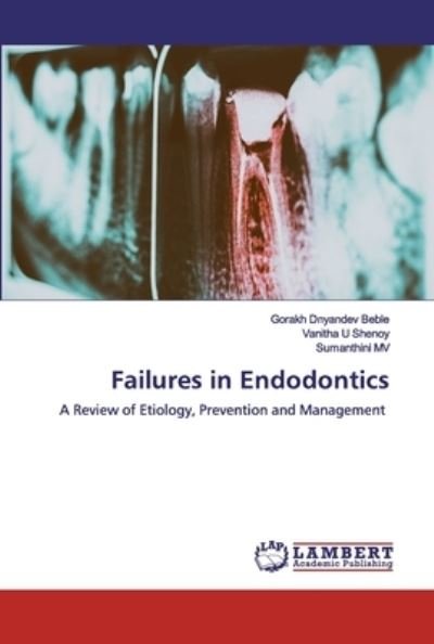 Cover for Beble · Failures in Endodontics (Book) (2020)
