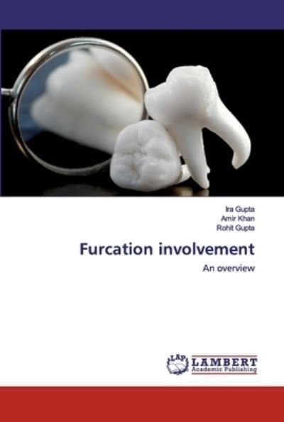 Cover for Gupta · Furcation involvement (Bok) (2020)