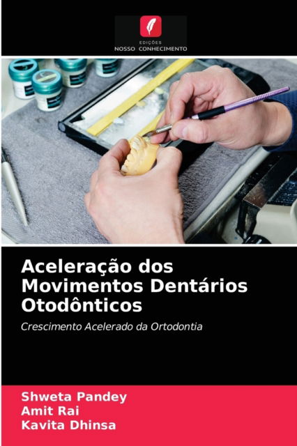 Cover for Shweta Pandey · Aceleracao dos Movimentos Dentarios Otodonticos (Paperback Book) (2021)