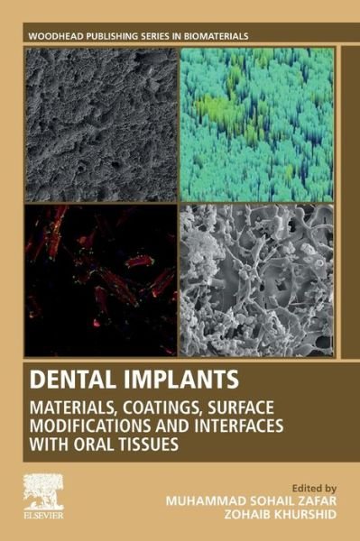 Dental Implants: Materials, Coatings, Surface Modifications and Interfaces with Oral Tissues - Woodhead Publishing Series in Biomaterials - Zafar, Muhammad (Department of Plant Systematics and Biodiversity Lab Quaid-i-Azam University,45320 Islamabad Pakistan) - Books - Elsevier Science Publishing Co Inc - 9780128195864 - July 23, 2020