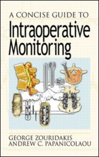 Cover for Zouridakis, George (University of Houston, Texas, USA University of Houston, Houston, Texas, USA University of Houston, Houston, Texas, USA University of Houston, Houston, Texas, USA University of Houston, Texas, USA) · A Concise Guide to Intraoperative Monitoring (Hardcover Book) (2000)
