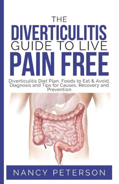 Cover for Nancy Peterson · THE DIVERTICULITIS GUIDE TO LIVE PAIN FREE : Diverticulitis Diet Plan, Foods to Eat &amp; Avoid, Diagnosis and Tips for Causes, Recovery and Prevention (Paperback Book) (2019)