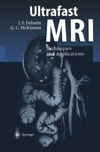 Cover for Jorg F. Debatin · Ultrafast MRI: Techniques and Applications (Paperback Bog) [Softcover reprint of the original 1st ed. 1998 edition] (2011)