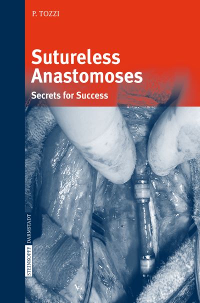 Cover for Piergiorgio Tozzi · Sutureless Anastomoses: Secrets for Success (Paperback Book) [Softcover reprint of the original 1st ed. 2007 edition] (2016)