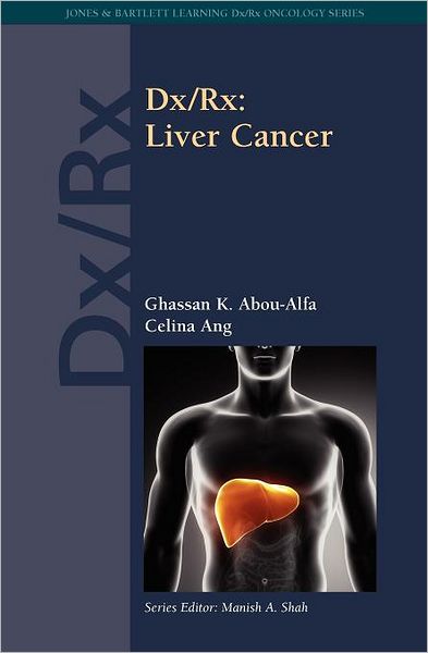 Cover for Ghassan K. Abou-Alfa · Dx/Rx: Liver Cancer: Liver Cancer (Paperback Book) [New edition] (2013)