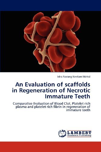 Cover for Isha Narang Neelam Mittal · An Evaluation of Scaffolds in Regeneration of Necrotic Immature Teeth (Paperback Book) (2012)
