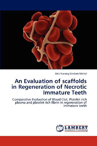 An Evaluation of Scaffolds in Regeneration of Necrotic Immature Teeth - Isha Narang Neelam Mittal - Bücher - LAP Lambert Academic Publishing - 9783659147869 - 4. Juni 2012