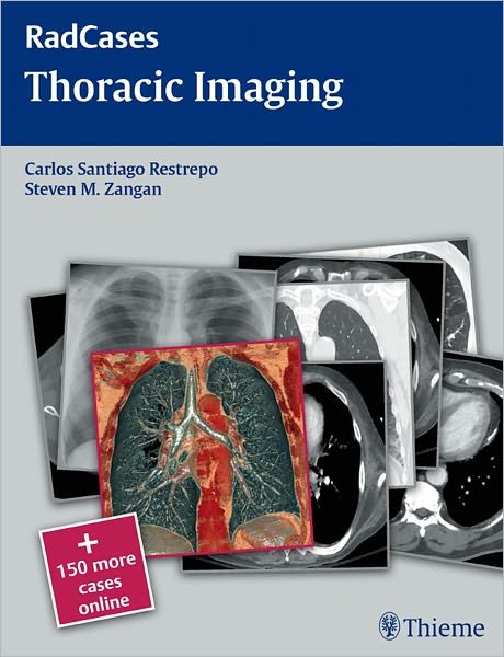Radcases Thoracic Imaging - Radcases Plus Q&A - Michael Galanski - Livros - Thieme Medical Publishers Inc - 9781604061871 - 18 de novembro de 2010