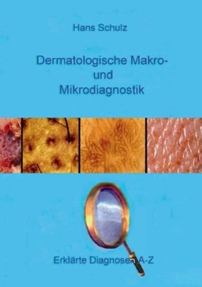 Cover for Hans Schulz · Dermatologische Makro- und Mikrodiagnostik (Book) (2022)