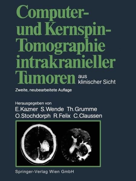 Cover for Ekkehard Kazner · Computer- Und Kernspin-Tomographie Intrakranieller Tumoren Aus Klinischer Sicht (Taschenbuch) [2nd 2. Aufl. 1988. Softcover Reprint of the Origin edition] (2014)