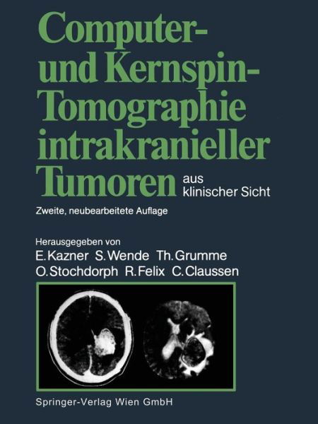 Cover for Ekkehard Kazner · Computer- Und Kernspin-Tomographie Intrakranieller Tumoren Aus Klinischer Sicht (Paperback Book) [2nd 2. Aufl. 1988. Softcover Reprint of the Origin edition] (2014)