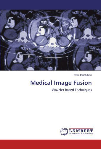 Cover for Latha Parthiban · Medical Image Fusion: Wavelet Based Techniques (Paperback Book) (2011)
